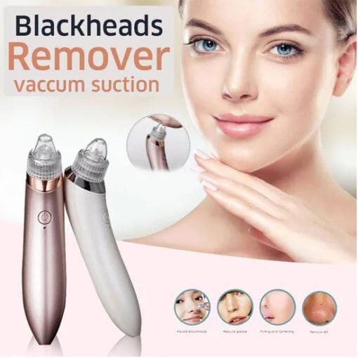 5 in 1 Blackhead Remover machine, Powerful Pimple Pore Cleaner, Vacuum Suction Tool